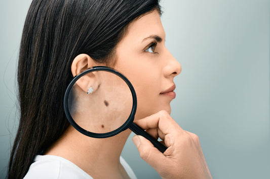 The Most Dangerous Effects of Sun Exposure on Your Skin